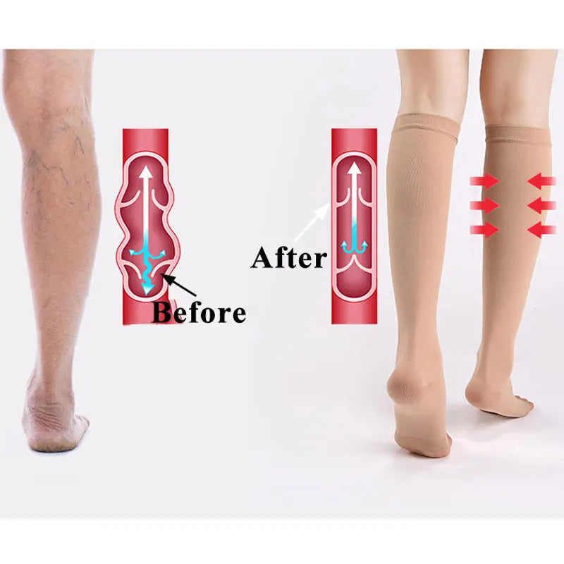 Compression Socks: Pressure Level 2, Stress Relief Compression Socks-1 Pair