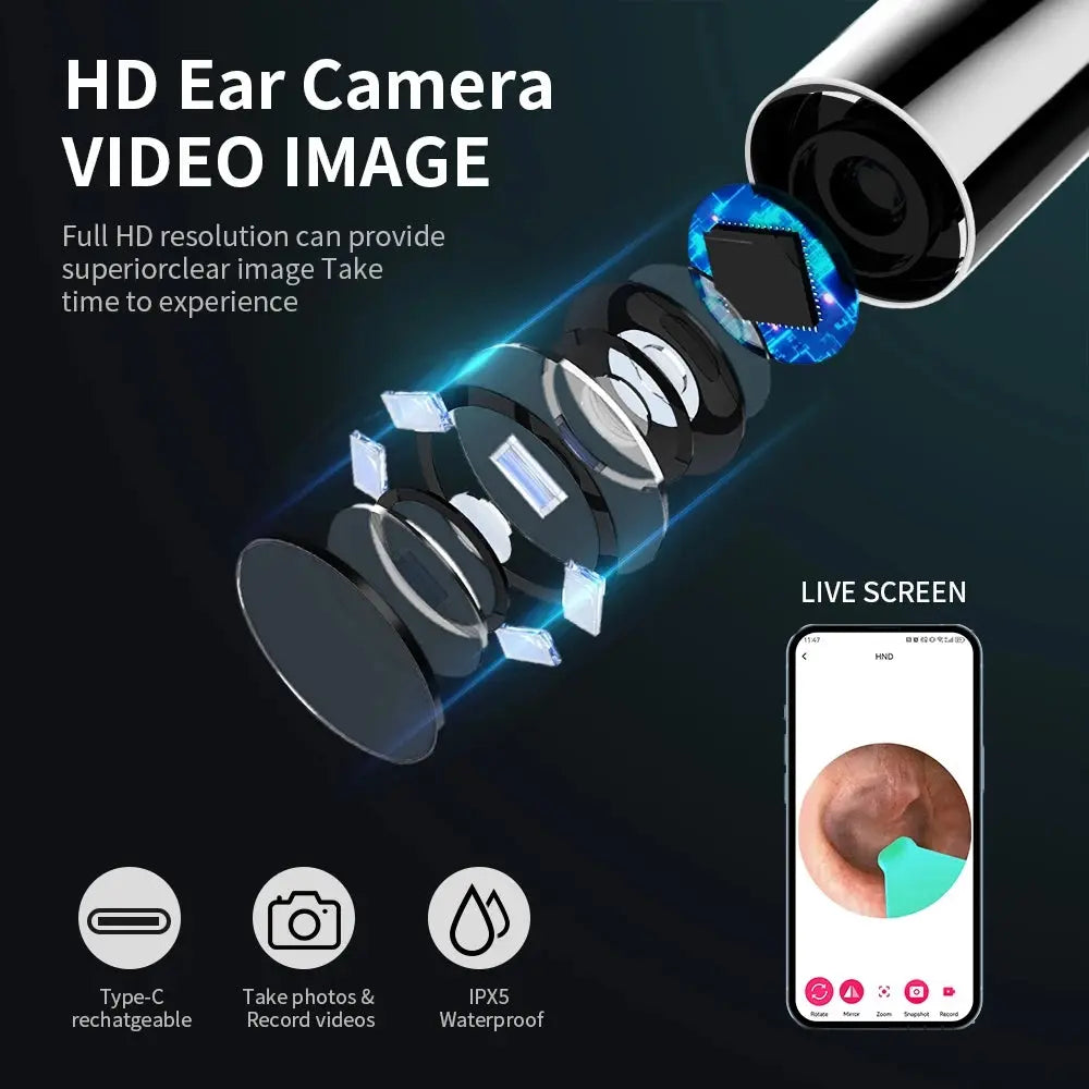 Camera Otoscope Earpick Set, USB C Charging Endoscope - Healthcare Vibes