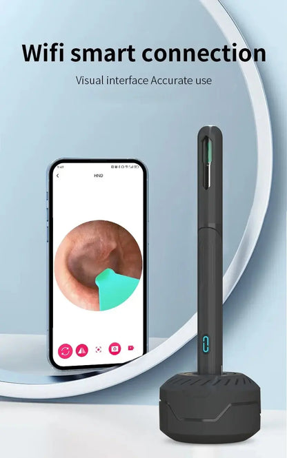Camera Otoscope Earpick Set, USB C Charging Endoscope - Healthcare Vibes